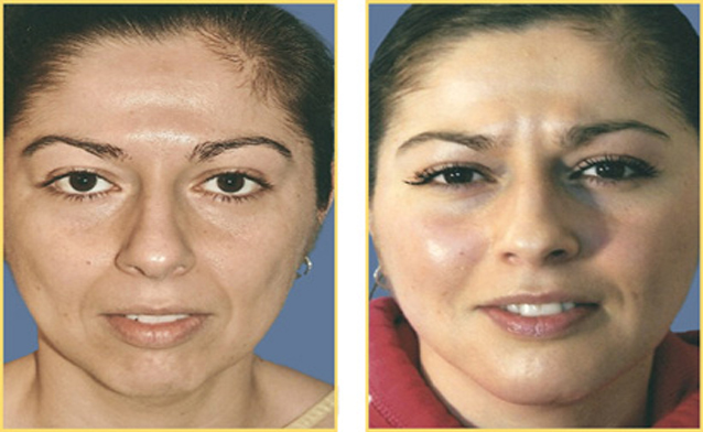 Beauty Clinics For Pigmentation Treatment