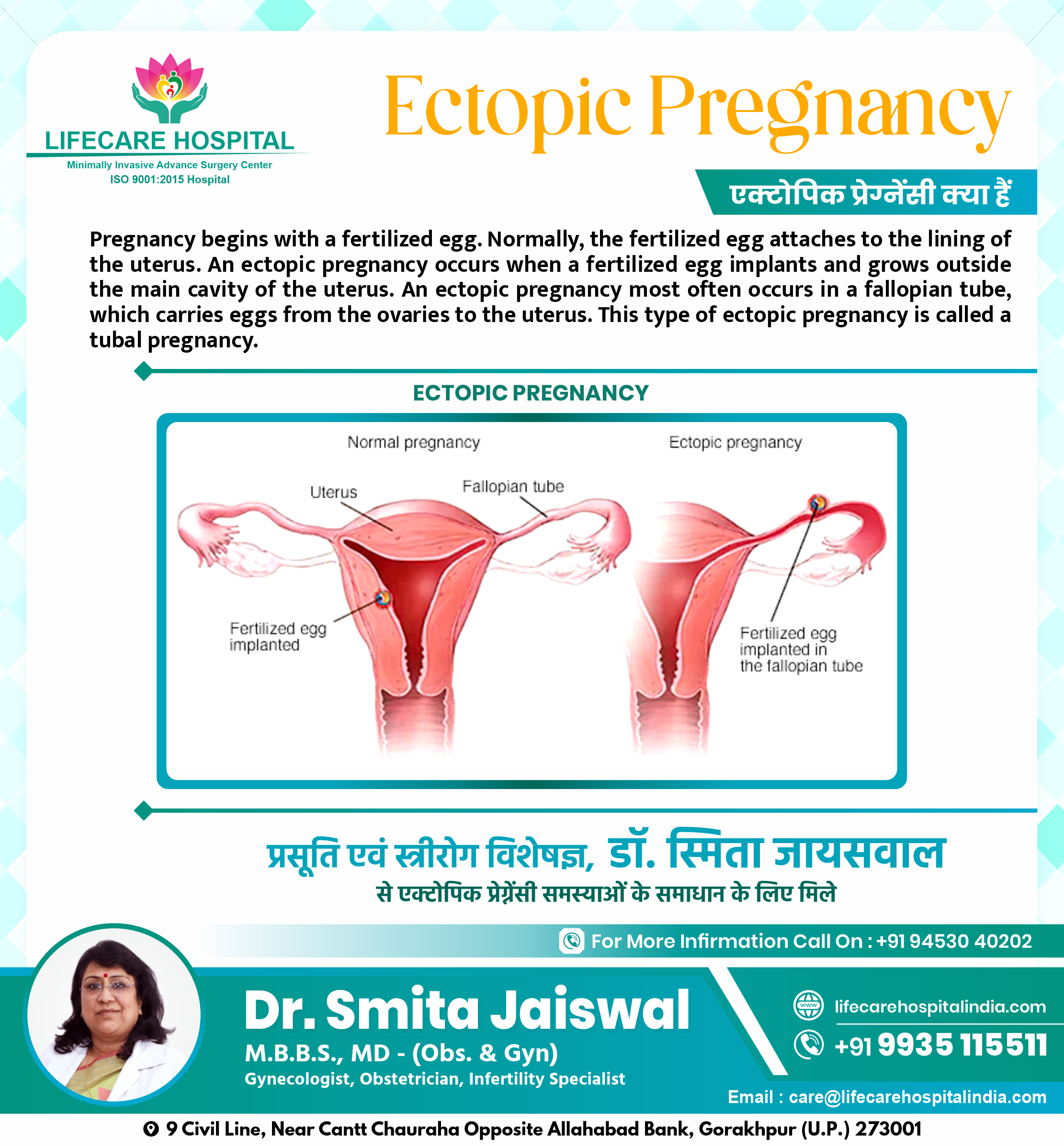 Ectopic Pregnancy LIFECARE HOSPITAL
