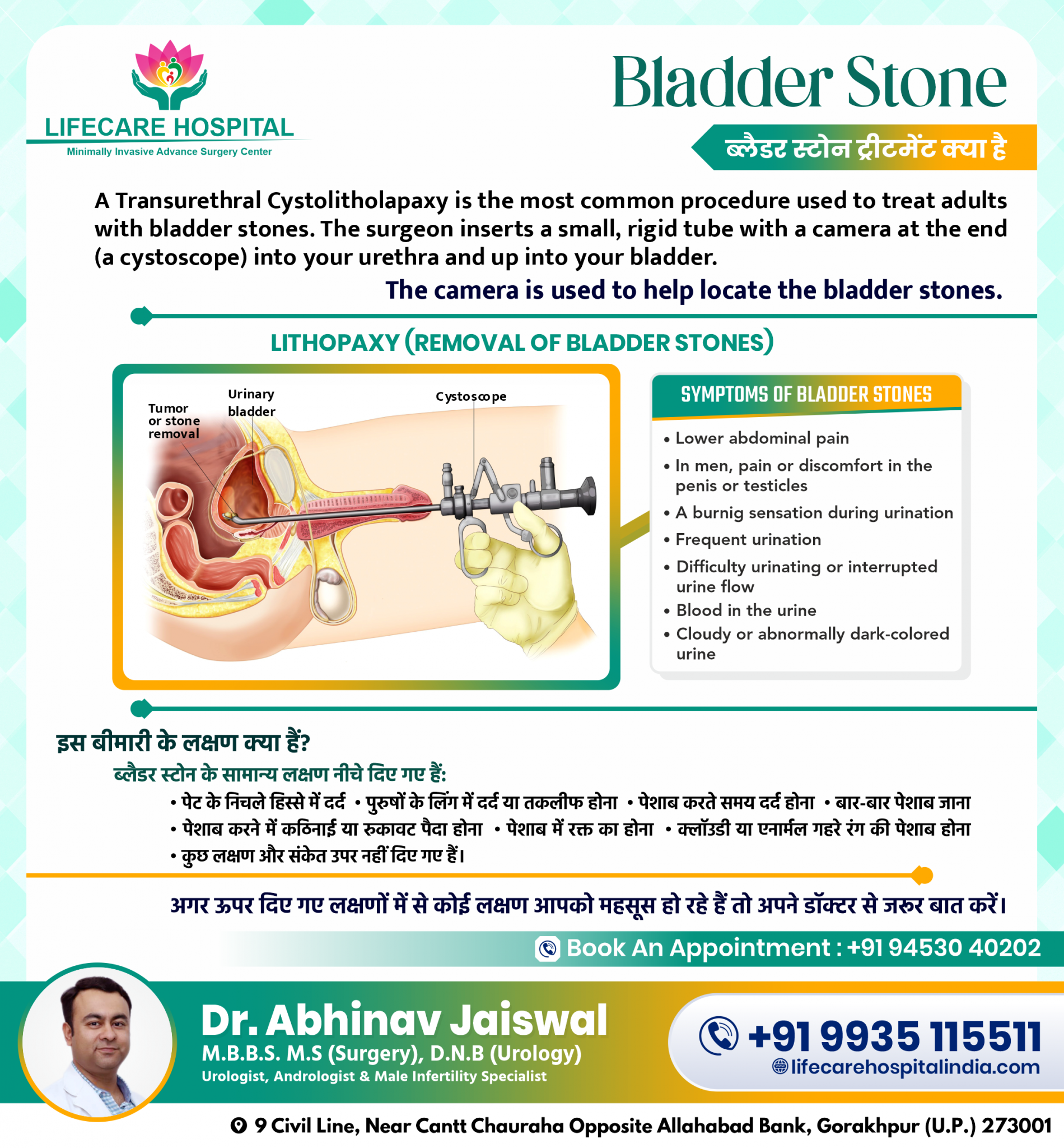 Bladder Stone - LIFECARE HOSPITAL