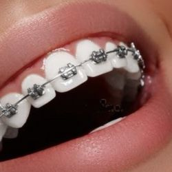 Anti Ageing Clinics